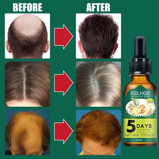 Anti Loss Scalp Promote Regrowth Treatment Hair Growth Serum Private Label Hair Care 